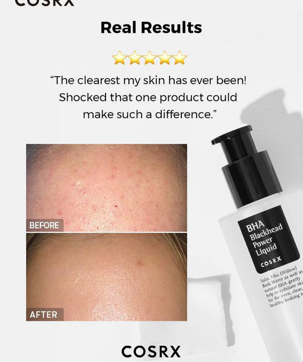 COSRX - BHA Blackhead Power Liquid